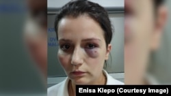 Enisa Klepo iz Jablanice koju je poslodavac Amir Džafić teško pretukao jer je dala otkaz i tražila zarađenu platu. 