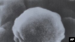1985 алда төшерелгән СПИД вирусы рәсеме